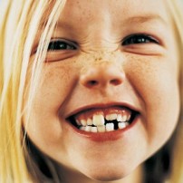 Caries infantiles